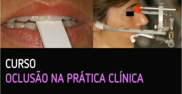 CESPU Oclusão na Prática Clínica Saúde Oral