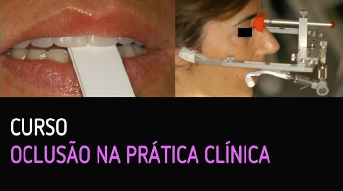 CESPU Oclusão na Prática Clínica Saúde Oral