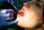 check up dentário Saúde Oral