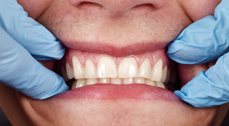 gengivas check up Saúde Oral