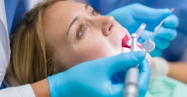 check-up dentário