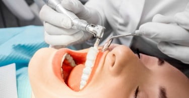 tratamentos dentários Saúde Oral