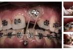 Foramen Dental Education