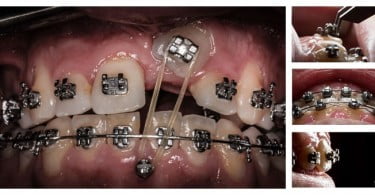 Foramen Dental Education