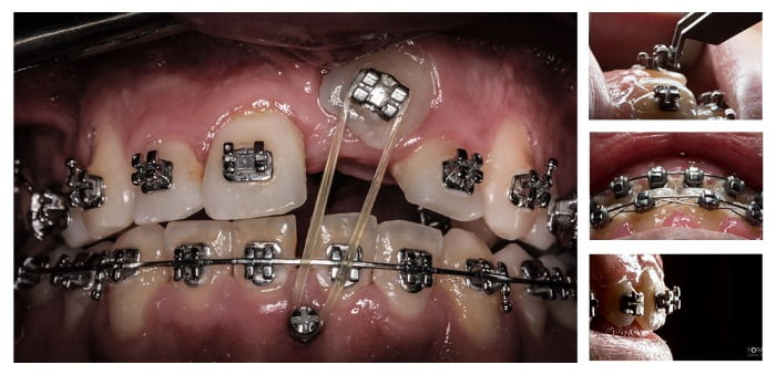 Foramen Dental Education