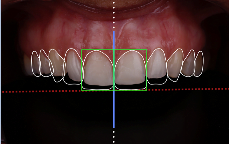 DSD
