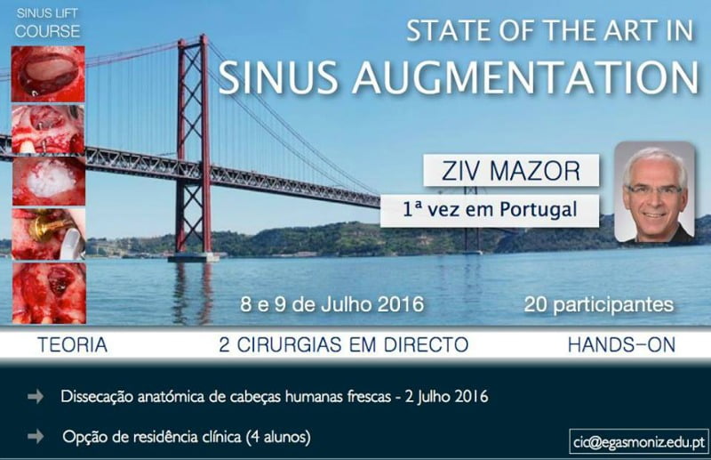 Elevação do Seio Nasal Saúde Oral