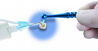 dossier de endodontia