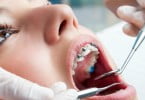 aparelhos dentários