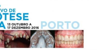 I Curso Intensivo de Prótese Fixa Centro de Estudos do Amial Saúde Oral