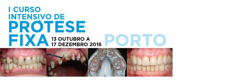 I Curso Intensivo de Prótese Fixa Centro de Estudos do Amial Saúde Oral