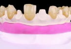 Tecno Med Mineral Zirkonzhan Saúde Oral
