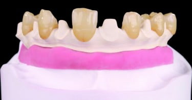 Tecno Med Mineral Zirkonzhan Saúde Oral
