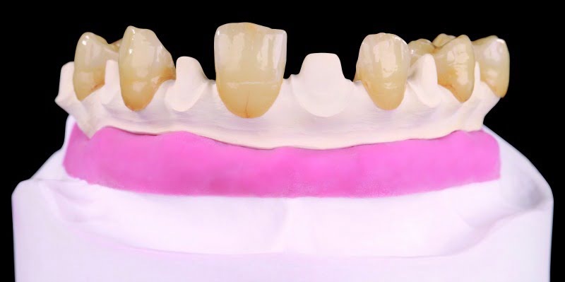 Tecno Med Mineral Zirkonzhan Saúde Oral