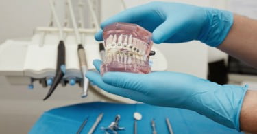 aparelho ortodôntico Saúde Oral