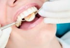 check up dentário Saúde Oral