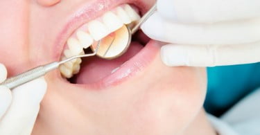 check up dentário Saúde Oral