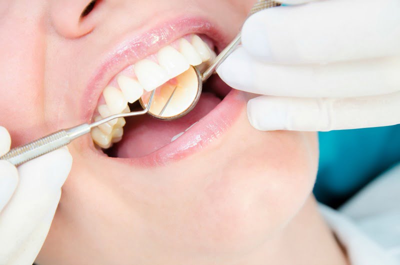 check up dentário Saúde Oral