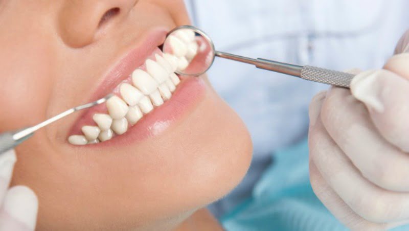 check up dentário Saúde Oral