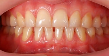 Dentina e EMS realizam 'Formação Periodontal'