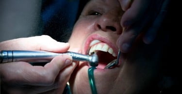 paciente no dentista Saúde Oral