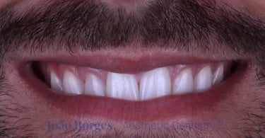 caso clinico saude oral