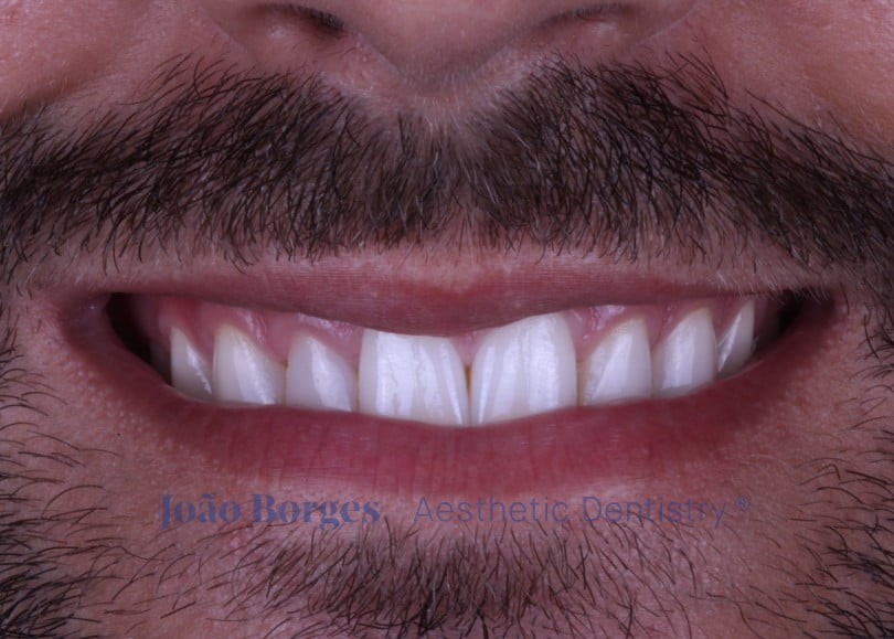 caso clinico saude oral