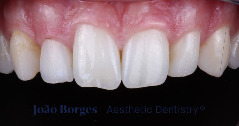 caso clinico saude oral