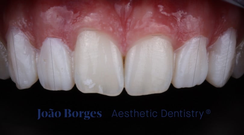 caso clinico saude oral