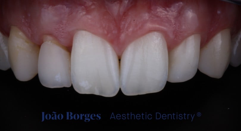 caso clinico saude oral