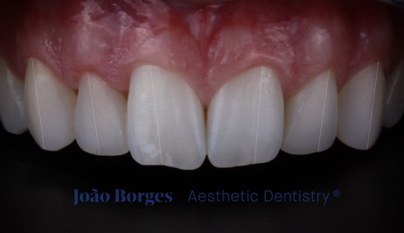 caso clinico saude oral