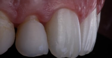 caso clinico saude oral