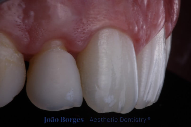 caso clinico saude oral