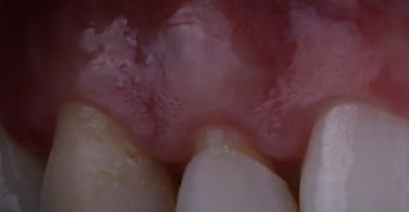 caso clinico saude oral