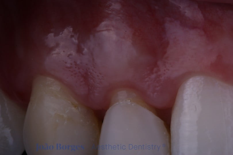 caso clinico saude oral