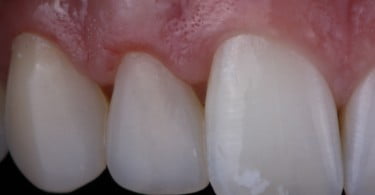 caso clinico saude oral