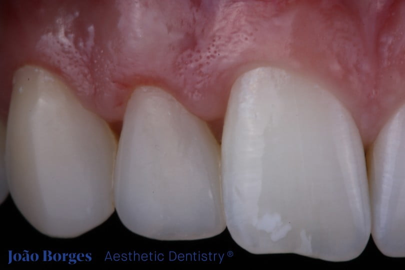 caso clinico saude oral