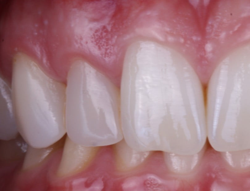 caso clinico saude oral