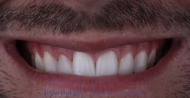 caso clinico saude oral