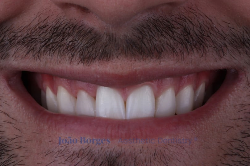 caso clinico saude oral