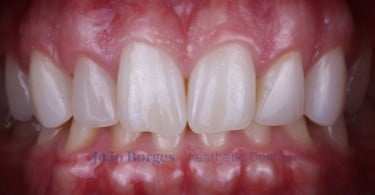 caso clinico saude oral Foto