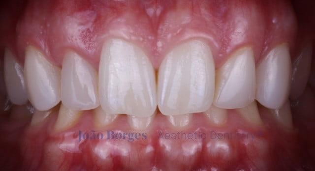 caso clinico saude oral Foto