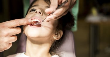 Infeções orais na infância podem ser fator de risco para desenvolvimento de arteriosclerose