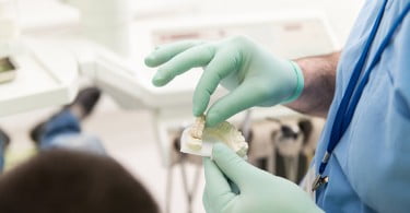 implantes dentários Saúde Oral
