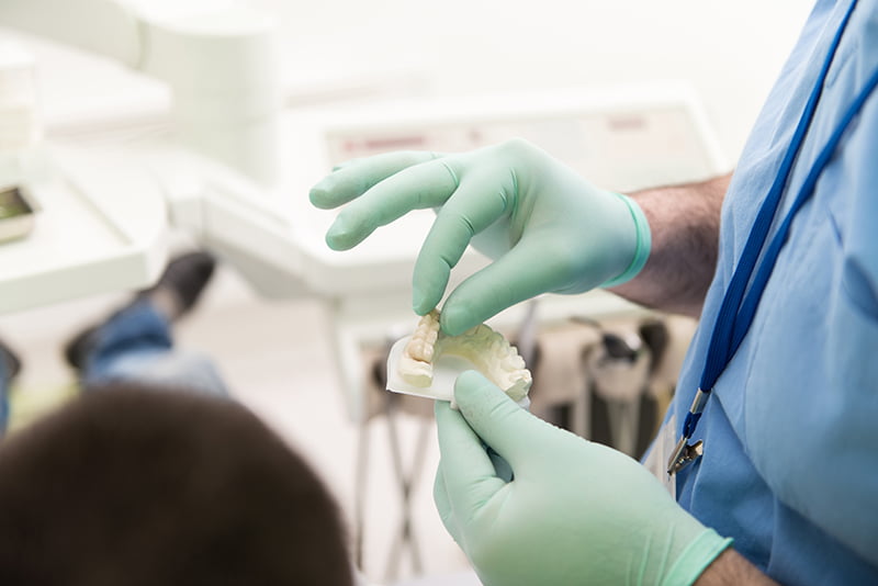 implantes dentários Saúde Oral