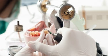 IVA das próteses dentárias