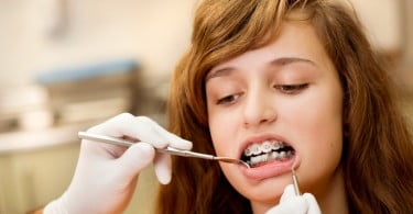 adolescente no dentista Saúde Oral