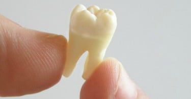 dente artificial Saúde Oral