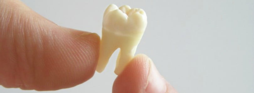 dente artificial Saúde Oral