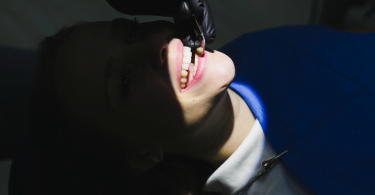 check up dentário ensaio clínico Saúde Oral